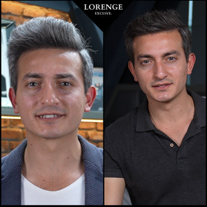 Lorenge — Champú en Barra Anticanas —  LLEVA 3 Y PAGA 2 (Promoción)