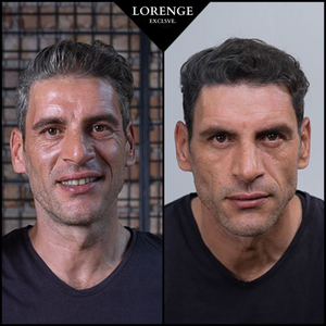 Lorenge — Champú en Barra Anticanas —  LLEVA 3 Y PAGA 2 (Promoción)