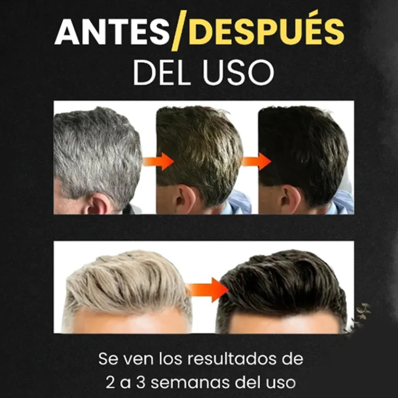 Lorenge — Champú en Barra Anticanas —  LLEVA 3 Y PAGA 2 (Promoción Exclusiva)